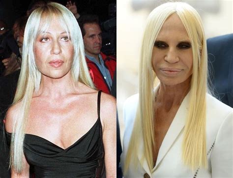 versace plastic surgery|donatella versace without plastic surgery.